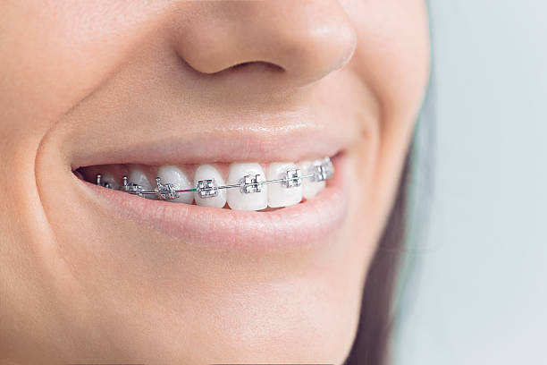 Best Veneers and Lumineers  in Pottsgrove, PA